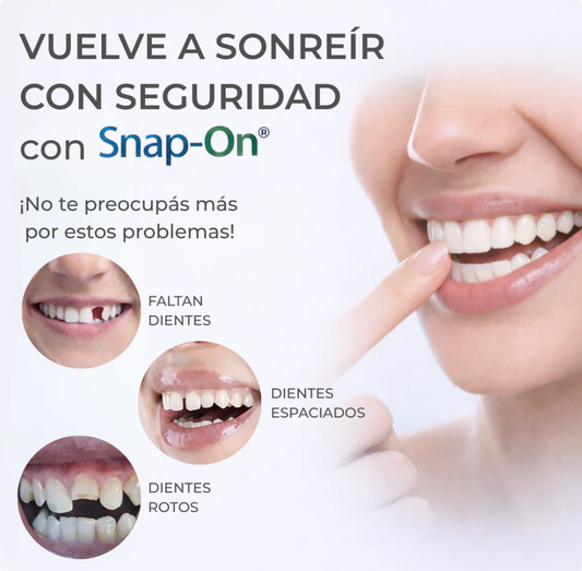 Snap Smile™ Carillas Dentales
